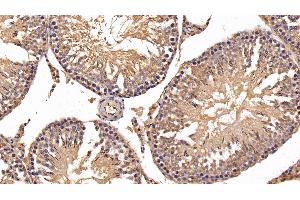 Detection of HK1 in Rat Testis Tissue using Polyclonal Antibody to Hexokinase 1 (HK1) (Hexokinase 1 antibody  (AA 80-215))