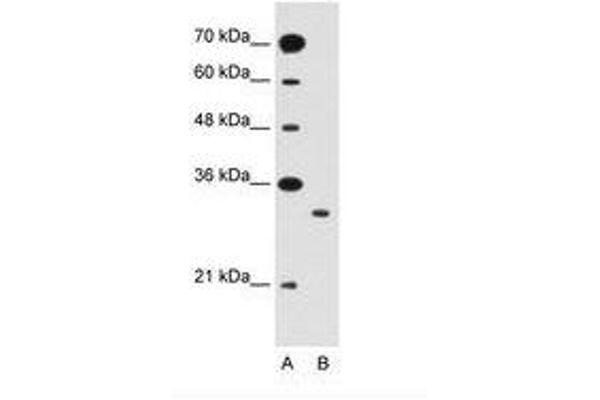 SLC25A22 antibody  (AA 131-180)