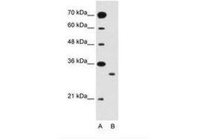 SLC25A22 Antikörper  (AA 131-180)