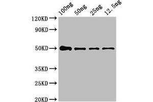 Western Blot Positive WB detected in Recombinant protein All lanes: NIPBL antibody at 4 μg/mL Secondary Goat polyclonal to rabbit IgG at 1/50000 dilution predicted band size: 50 kDa observed band size: 50 kDa (NIPBL antibody  (AA 2523-2697))