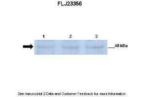 Lanes:   Lane 1: 30ug mouse renal epithelial lysate Lane 2: 30ug mouse renal epithelial lysate Lane 3: 30ug mouse renal epithelial lysate  Primary Antibody Dilution:   1:500  Secondary Antibody:   Anti-rabbit-HRP  Secondary Antibody Dilution:   1:2500  Gene Name:   FLJ23356  Submitted by:   Dr. (SGK196 antibody  (N-Term))