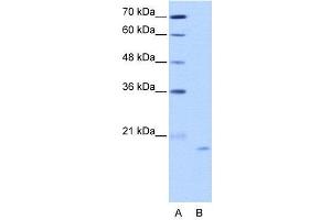 WB Suggested Anti-NOL6  Antibody Titration: 2. (Nucleolar Protein 6 antibody  (C-Term))