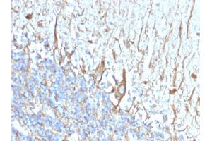Formalin-fixed, paraffin-embedded human Cerebellum stained with Neurofilament Mouse Monoclonal Antibody (2F11). (NEFH & NEFL antibody)