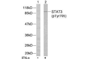 Image no. 2 for anti-Signal Transducer and Activator of Transcription 3 (Acute-Phase Response Factor) (STAT3) (pTyr705) antibody (ABIN196690) (STAT3 antibody  (pTyr705))