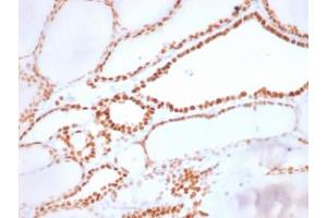 IHC: Formalin-fixed, paraffin-embedded human thyroid stained with recombinant NKX2. (NKX2-1 antibody)