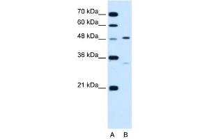 CHST1 antibody used at 1. (CHST1 antibody)
