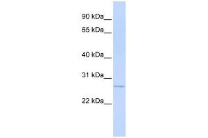 WB Suggested Anti-MTHFS Antibody Titration: 0. (MTHFS antibody  (Middle Region))