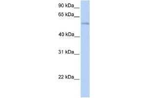 Western Blotting (WB) image for anti-Phospholipase D family member 3 (PLD3) antibody (ABIN2458891) (PLD3 antibody)