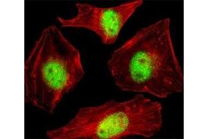 Fluorescent confocal image of HeLa cell stained with SUMO2/3 Antibody antibody at 1:25. (SUMO2/3 antibody  (AA 53-84))