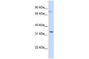 WB Suggested Anti-SIGLEC6 Antibody Titration:  0.