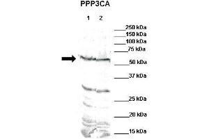 WB Suggested Anti-PPP3CA Antibody    Positive Control:  Lane 1: 80ug mouse brain extractLane 2: 80ug rat brain extract  Primary Antibody Dilution :   1:500  Secondary Antibody :  IRDye 800 CW goat anti-rabbit from Li-COR Bioscience  Secondry Antibody Dilution :   1:20,000  Submitted by:  Dr. (PPP3CA antibody  (N-Term))