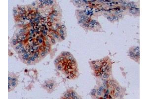 Detection of VIM in Human Prostate Tissue using Polyclonal Antibody to Vimentin (VIM) (Vimentin antibody  (AA 2-466))