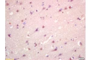 Formalin-fixed and paraffin embedded human brain labeled with Anti-CCBR1 Polyclonal Antibody, Unconjugated (ABIN872924) at 1:200 followed by conjugation to the secondary antibody and DAB staining (SLC7A11 antibody  (AA 201-300))