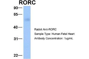 Host: Rabbit Target Name: RORC Sample Type: Human Fetal Heart Antibody Dilution: 1. (RORC antibody  (C-Term))