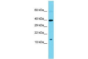 Western Blotting (WB) image for anti-Sperm Associated Antigen 11B (SPAG11B) (N-Term) antibody (ABIN2774058) (SPAG11B antibody  (N-Term))