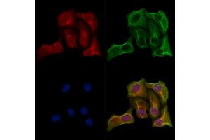 ABIN7094754 and ABIN7098805 staining Hela cells by IF/ICC.