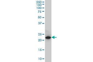 C13orf1 monoclonal antibody (M01), clone 2G4 Western Blot analysis of C13orf1 expression in PC-12 . (CLLD6 antibody  (AA 97-196))