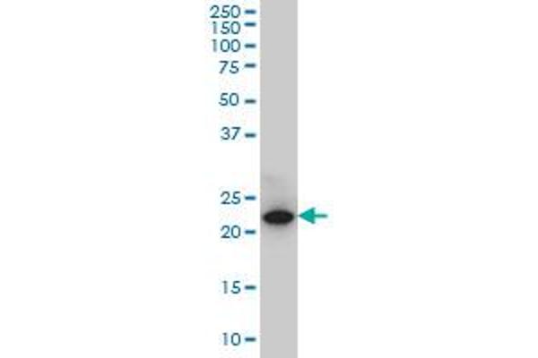 CLLD6 antibody  (AA 97-196)