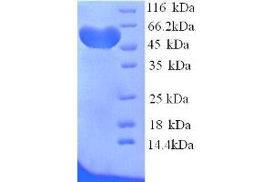 Hemopexin (HPX) (AA 24-460), (full length) protein (His tag) (Hemopexin Protein (HPX) (AA 24-460, full length) (His tag))