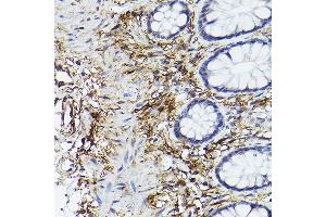 Immunohistochemistry of paraffin-embedded human colon using CD90/Thy1 Rabbit mAb (ABIN6129735, ABIN6148554, ABIN6148555 and ABIN7101405) at dilution of 1:100 (40x lens). (CD90 antibody)