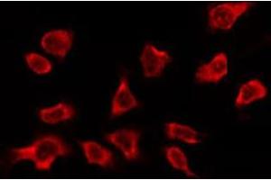 ABIN6278605 staining Hela by IF/ICC. (OR2A5/2A14 antibody)