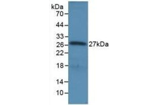 RNASEL antibody  (AA 358-583)