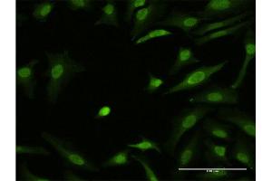 Immunofluorescence of monoclonal antibody to ZIC3 on HeLa cell. (ZIC3 antibody  (AA 182-274))