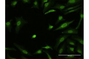 Immunofluorescence of monoclonal antibody to ZIC3 on HeLa cell.
