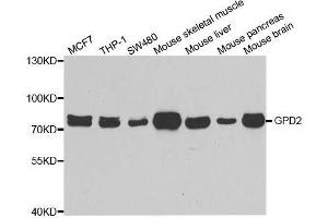 Western blot analysis of extracts of various cell lines, using GPD2 antibody. (GPD2 antibody  (AA 25-325))