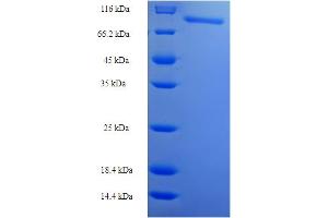 SDS-PAGE (SDS) image for Ribonucleotide Reductase M1 (RRM1) (AA 1-761), (full length) protein (His-SUMO Tag) (ABIN5710974) (RRM1 Protein (AA 1-761, full length) (His-SUMO Tag))