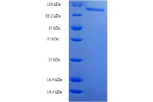 SDS-PAGE (SDS) image for Ribonucleotide Reductase M1 (RRM1) (AA 1-761), (full length) protein (His-SUMO Tag) (ABIN4975283)