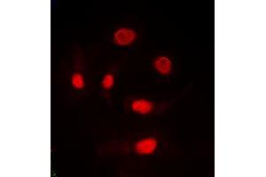 Immunofluorescent analysis of TRA2A staining in HeLa cells.