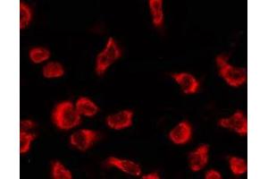 ABIN6278609 staining Hela by IF/ICC. (OR4C12 antibody  (Internal Region))