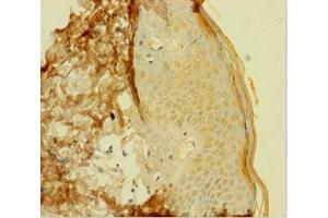 Immunohistochemistry of paraffin-embedded human skin tissue using ABIN7154376 at dilution of 1:100 (GRHL2 antibody  (AA 1-265))