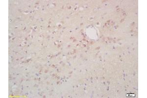 Formalin-fixed and paraffin embedded rat brain labeled with Rabbit Anti phospho-NIFK/MKI67IP(Thr234) Polyclonal Antibody, Unconjugated (ABIN872293) at 1:200 followed by conjugation to the secondary antibody and DAB staining (NIFK antibody  (pThr234))
