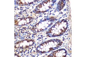 Immunohistochemistry of paraffin-embedded Human colon using FGF2 Rabbit pAb (ABIN3020744, ABIN3020745, ABIN3020746 and ABIN6213702) at dilution of 1:100 (40x lens). (FGF2 antibody  (AA 143-288))