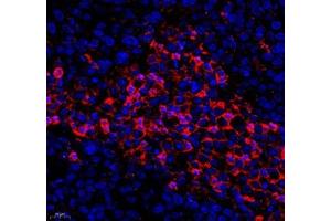 Immunofluorescence of paraffin embedded human ovarian cancer using KCTD19 (ABIN7075147) at dilution of 1: 500 (400x lens) (KCTD19 antibody)