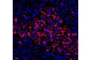 Immunofluorescence of paraffin embedded human ovarian cancer using KCTD19 (ABIN7075147) at dilution of 1: 500 (400x lens) (KCTD19 antibody)