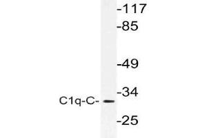Western blot (WB) analysis of C1q-C antibody in extracts from rat lung cells.