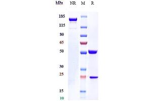 Anti-IL-31Ra Reference Antibody (nemolizumab) on SDS-PAGE under reducing (R) condition. (Recombinant IL31RA (Nemolizumab Biosimilar) antibody)