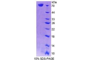 SDS-PAGE analysis of Mouse CRTAP Protein. (CRTAP Protein)