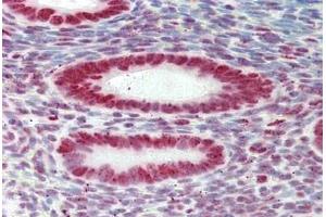 Human Uterus: Formalin-Fixed, Paraffin-Embedded (FFPE) (HNRNPAB antibody  (AA 1-30))