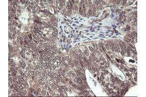 Image no. 1 for anti-Parvin, alpha (PARVA) antibody (ABIN1496442) (Parvin alpha antibody)