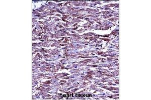 P15 Antibody (N-term) ((ABIN657673 and ABIN2846665))iunohistochemistry analysis in formalin fixed and paraffin embedded human heart tissue followed by peroxidase conjugation of the secondary antibody and DAB staining. (MMP15 antibody  (N-Term))