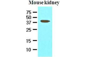 Western Blotting (WB) image for anti-Apoptosis, Caspase Activation Inhibitor (AVEN) (AA 254-362) antibody (ABIN336089) (AVEN antibody  (AA 254-362))