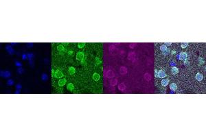 Immunohistochemistry (IHC) image for anti-Oligodendrocyte Lineage Transcription Factor 2 (OLIG2) antibody (ABIN7456034) (OLIG2 antibody)