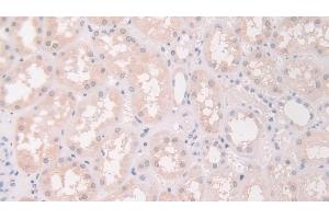 Immunohistochemistry (IHC) image for anti-Flightless I Homolog (FLII) (AA 896-1176) antibody (ABIN7436756)
