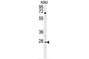 CXCR3 Antibody (Center) western blot analysis in K562 cell line lysates (35µg/lane). (CXCR3 antibody  (Middle Region))