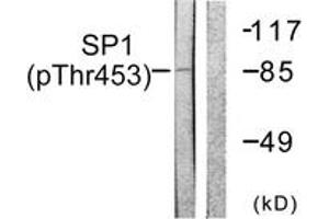 Western blot analysis of extracts from A549 cells, using SP1 (Phospho-Thr453) Antibody. (SP1 antibody  (pThr453))