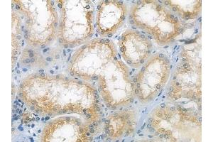 ABIN6260882 and ABIN6279306 at 1/100 staining human normal kidney tissue by IHC-P. (Claudin 20 antibody  (C-Term))